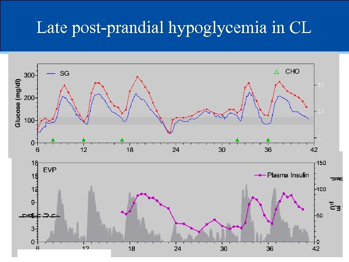 Late post-prandial hypoglycemia in CL 