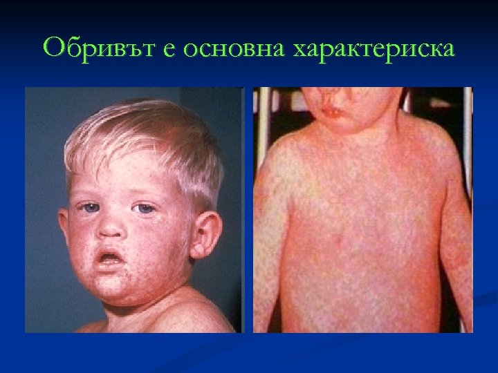 Обривът е основна характериска 