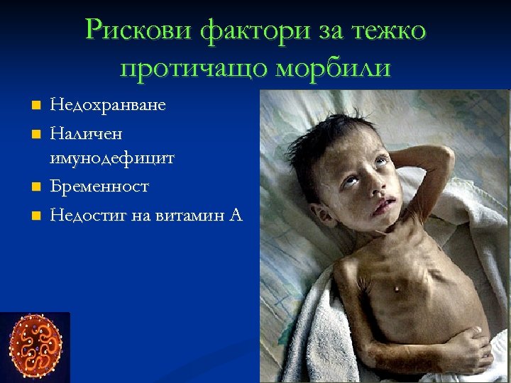 Рискови фактори за тежко протичащо морбили Недохранване Наличен имунодефицит Бременност Недостиг на витамин A