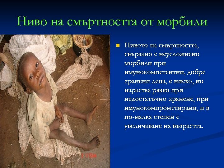 Ниво на смъртността от морбили Нивото на смъртността, свързано с неусложнено морбили при имунокомпетентни,