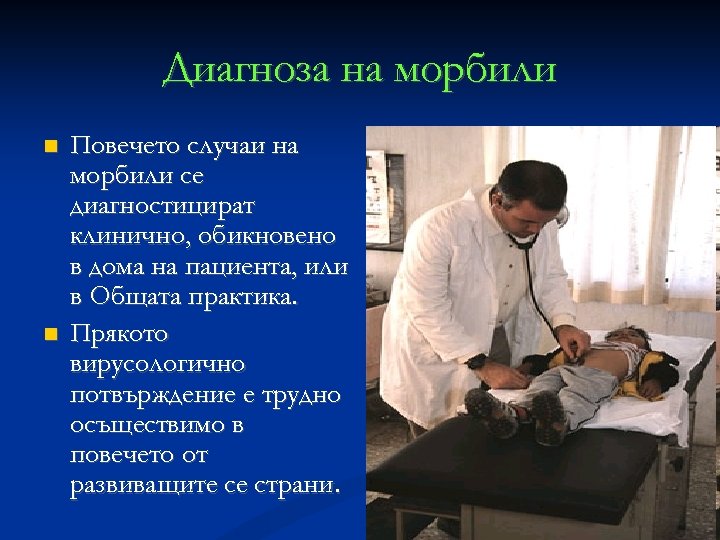 Диагноза на морбили Повечето случаи на морбили се диагностицират клинично, обикновено в дома на