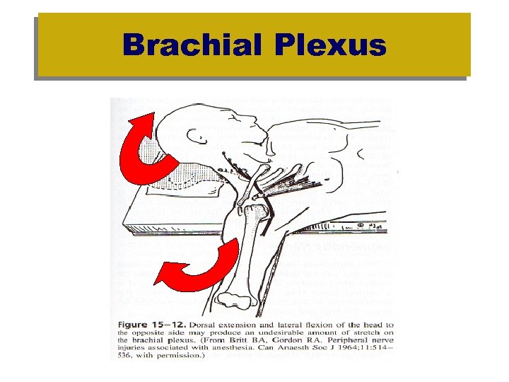 Brachial Plexus 