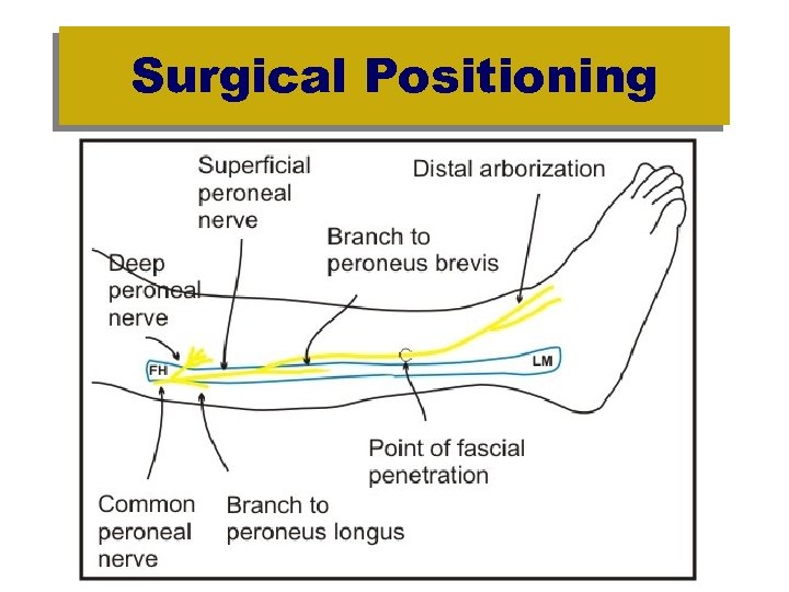 Surgical Positioning 