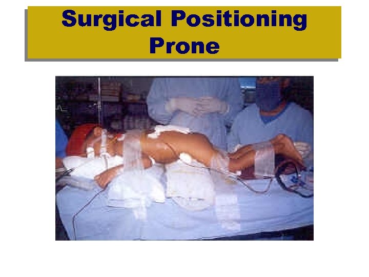 Surgical Positioning Prone 