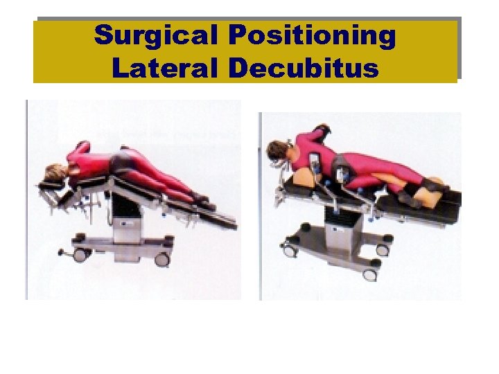 Surgical Positioning Lateral Decubitus 