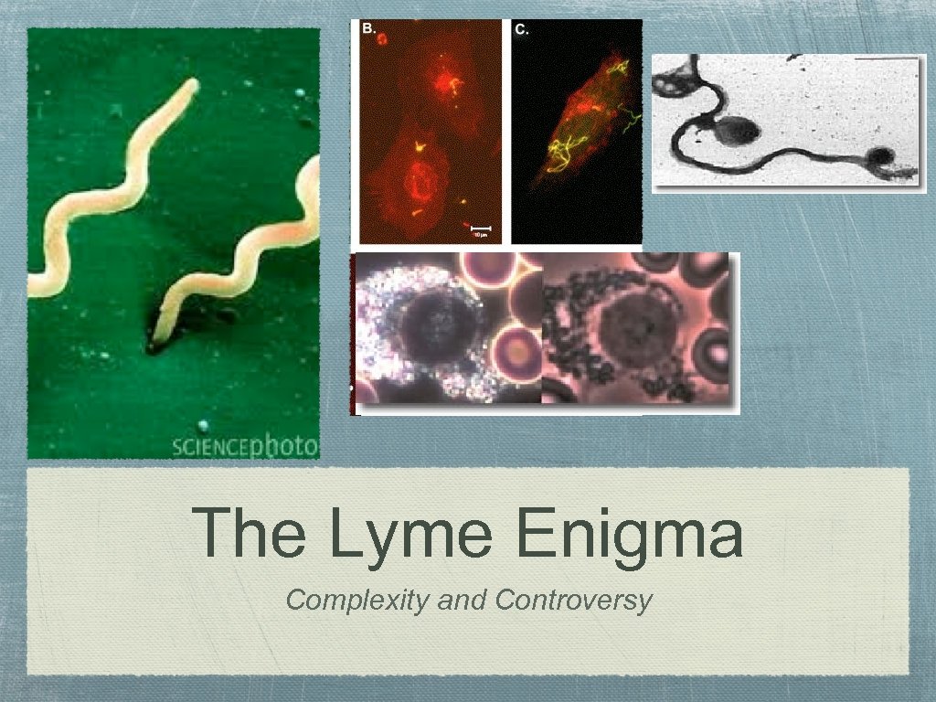 The Lyme Enigma Complexity and Controversy 