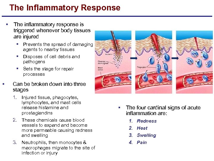 The Inflammatory Response § The inflammatory response is triggered whenever body tissues are injured