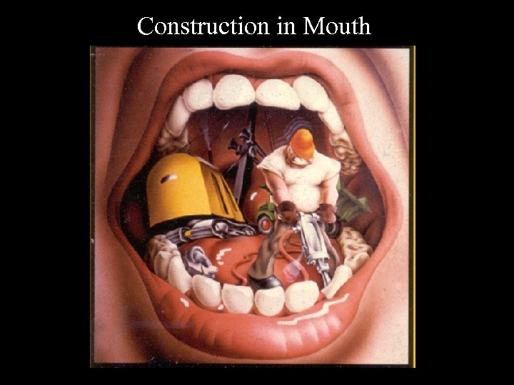 Construction in Mouth 