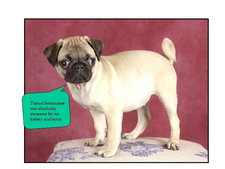 Topical benzocaine was absolutely awesome for my battery acid burns 