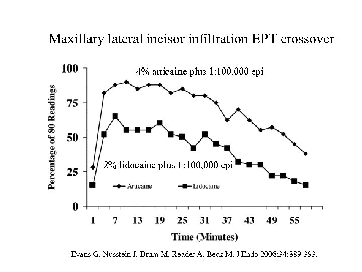 Maxillary lateral incisor infiltration EPT crossover 4% articaine plus 1: 100, 000 epi 2%