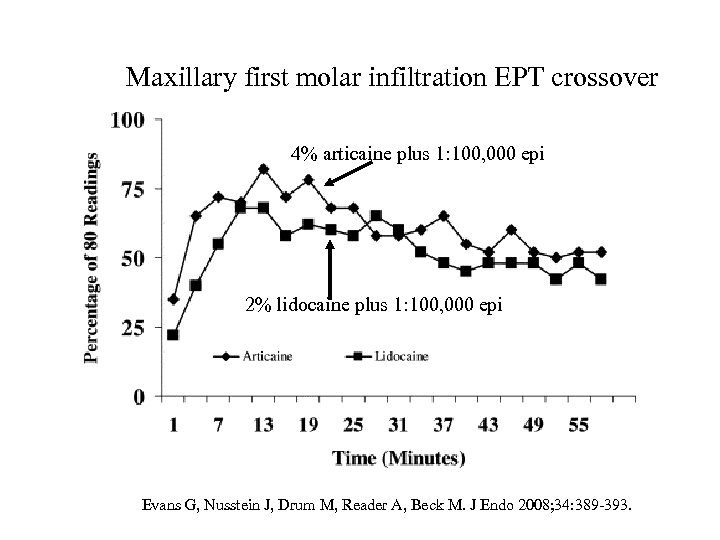 Maxillary first molar infiltration EPT crossover 4% articaine plus 1: 100, 000 epi 2%