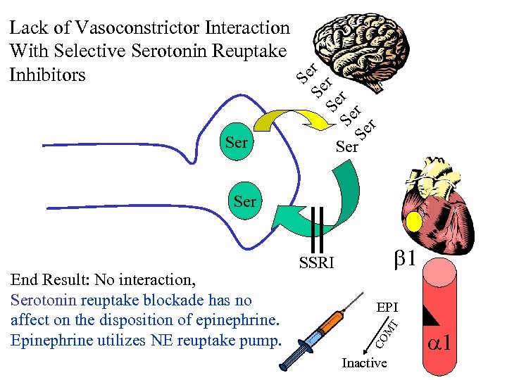 Ser Se Se r r Lack of Vasoconstrictor Interaction With Selective Serotonin Reuptake Inhibitors