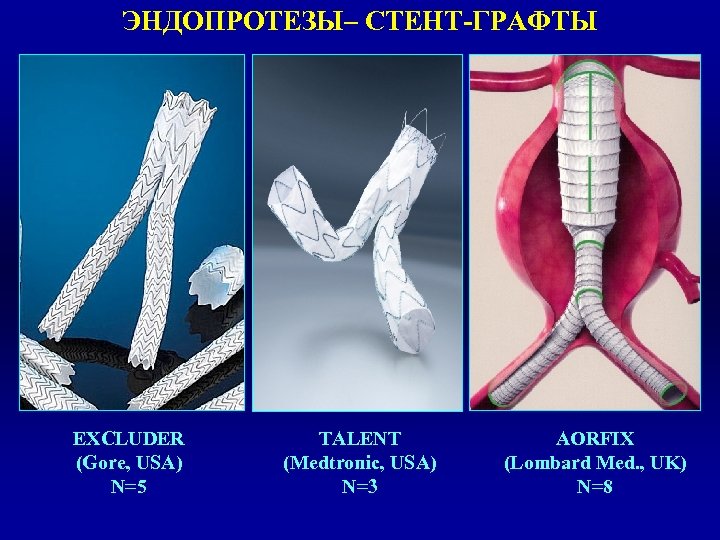 ЭНДОПРОТЕЗЫ– СТЕНТ-ГРАФТЫ EXCLUDER (Gore, USA) N=5 TALENT (Medtronic, USA) N=3 AORFIX (Lombard Med. ,