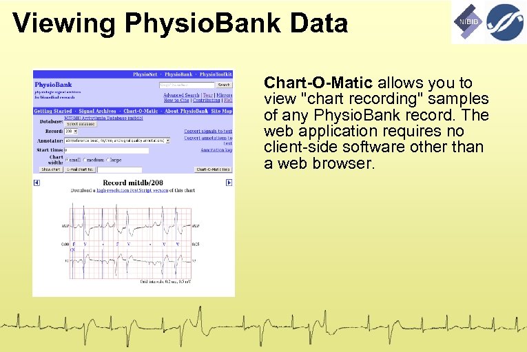 Viewing Physio. Bank Data Chart-O-Matic allows you to view "chart recording" samples of any