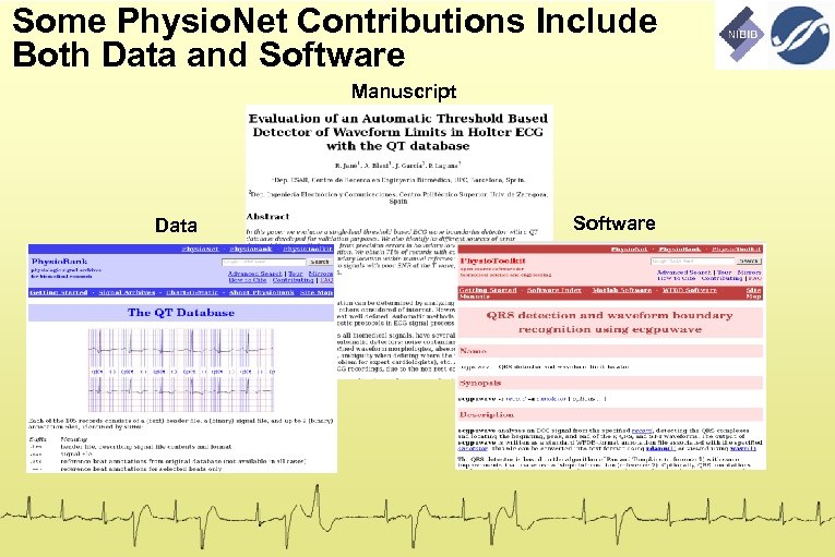 Some Physio. Net Contributions Include Both Data and Software Manuscript Data Software 