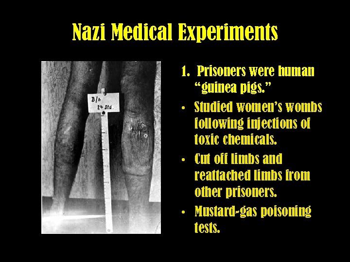 Nazi Medical Experiments 1. Prisoners were human “guinea pigs. ” • Studied women’s wombs