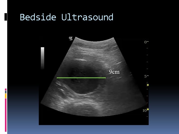 Bedside Ultrasound 9 cm 