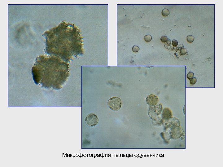 Микрофотография пыльцы одуванчика 