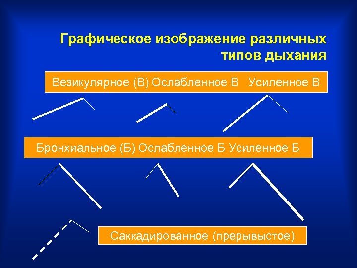 Графическое изображение различных типов дыхания Везикулярное (В) Ослабленное В Усиленное В Бронхиальное (Б) Ослабленное