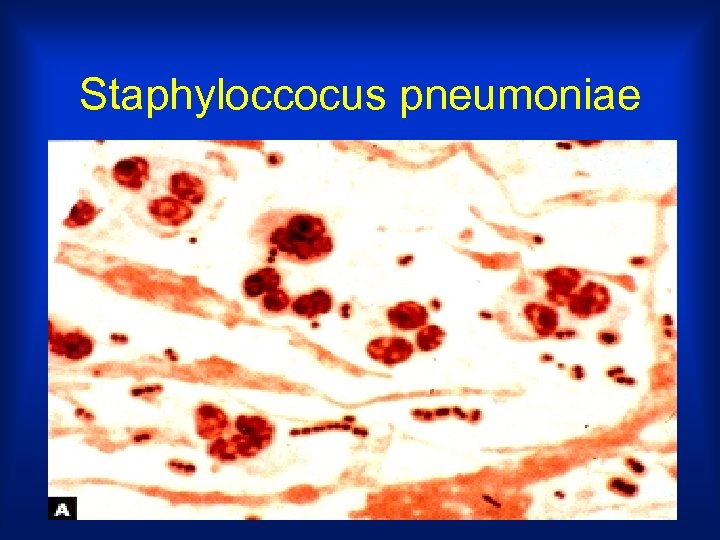 Staphyloccocus pneumoniae 