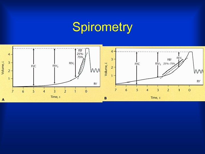 Spirometry 