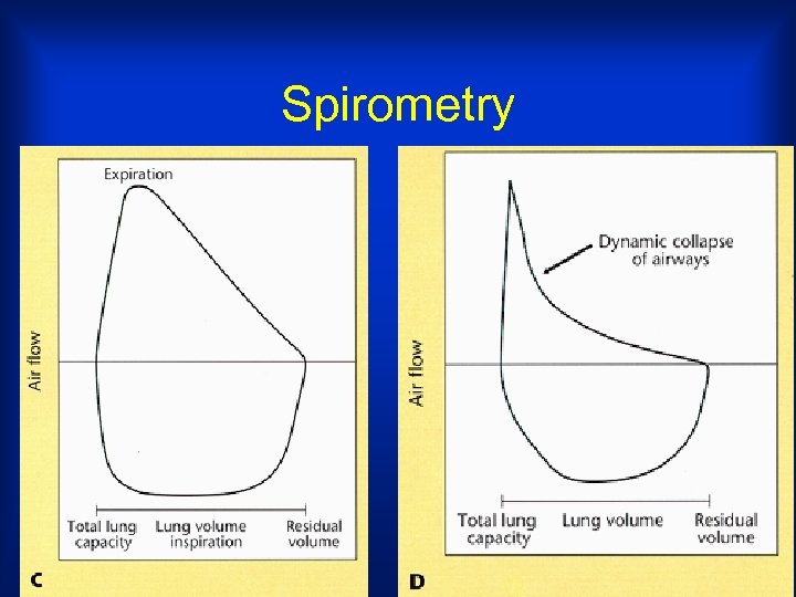 Spirometry 
