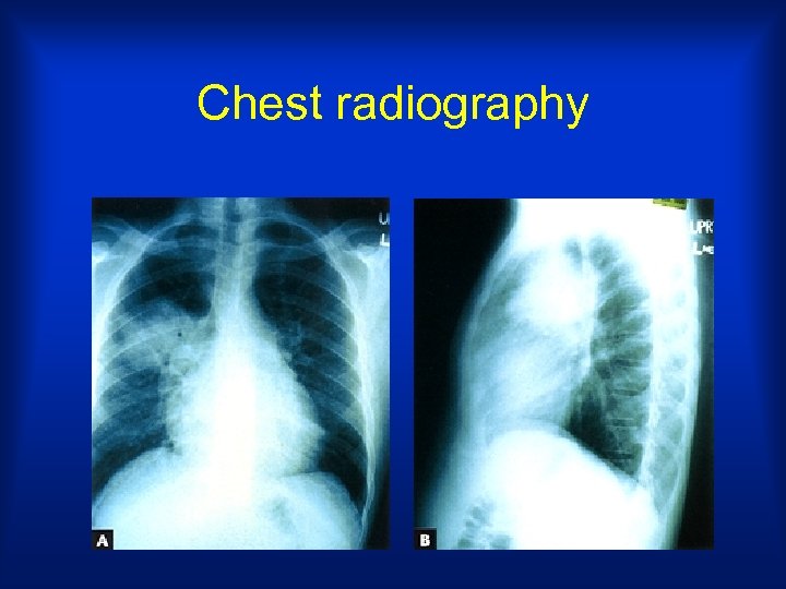 Chest radiography 