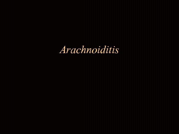 Arachnoiditis 
