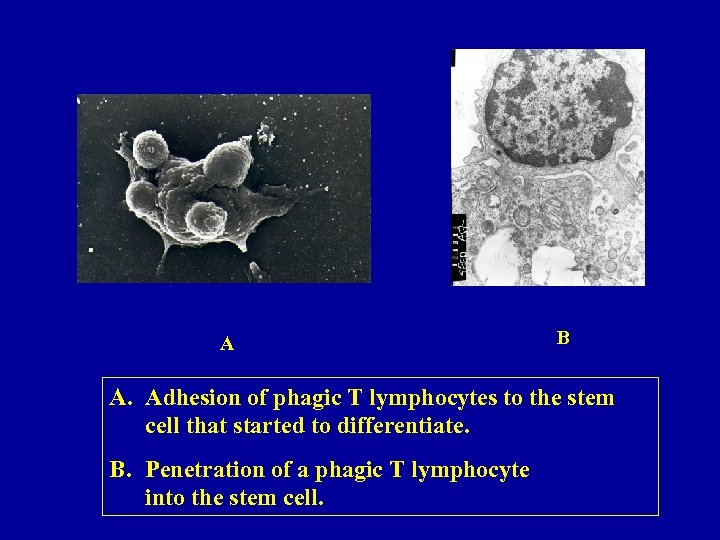 A B A. Adhesion of phagic T lymphocytes to the stem cell that started