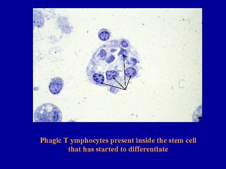 Phagic T ymphocytes present inside the stem cell that has started to differentiate 