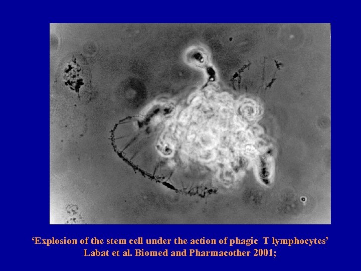 ‘Explosion of the stem cell under the action of phagic T lymphocytes’ Labat et