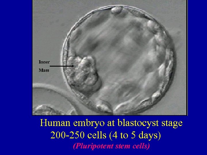 Inner Mass Human embryo at blastocyst stage 200 -250 cells (4 to 5 days)