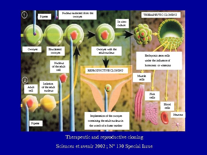 Nucleus extracted from the ovocyte Pipette THERAPEUTIC CLONING In vitro culture Ovocyte Enucleated ovocyte