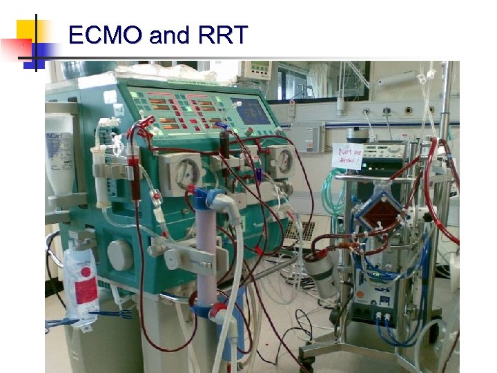 ECMO and RRT 