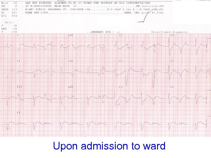 Upon admission to ward 