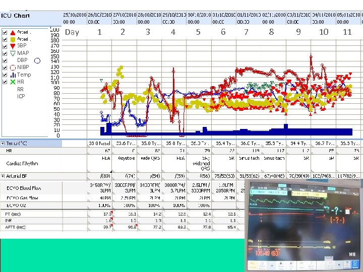 Day SBP MAP DBP NIBP Temp HR RR ICP 1 2 3 4 5
