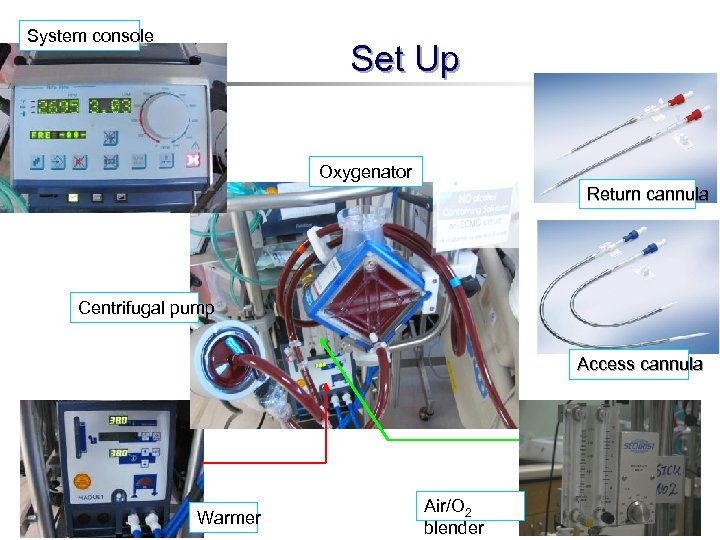 System console Set Up Oxygenator Return cannula Centrifugal pump Access cannula Warmer Air/O 2