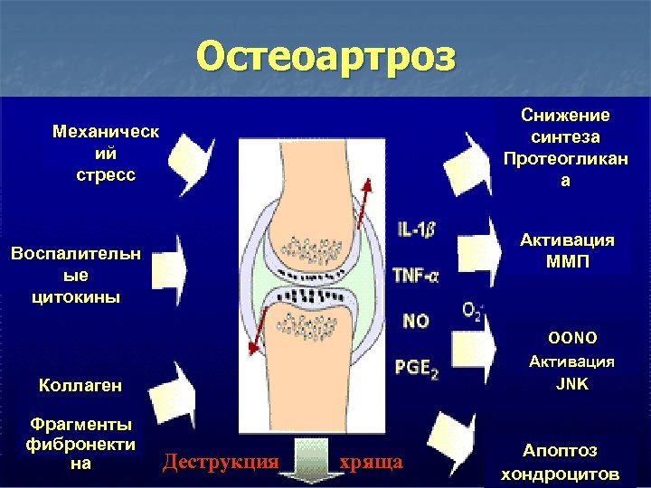 Остеоартроз Снижение синтеза Протеогликан а Механическ ий стресс ИЛ 1 ФНО О 2 NO