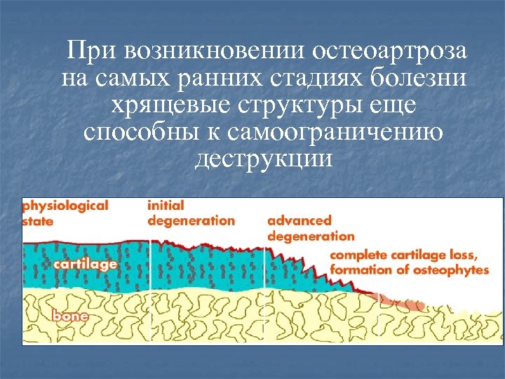 При возникновении остеоартроза на самых ранних стадиях болезни хрящевые структуры еще способны к самоограничению