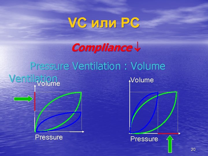 VC или РС Compliance Pressure Ventilation : Volume Ventilation Volume Pressure 20 