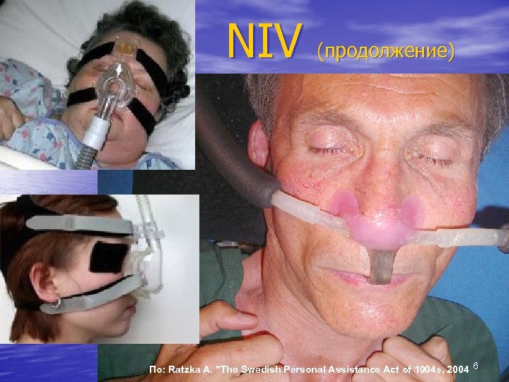 NIV (продолжение) По: Ratzka A. "The Swedish Personal Assistance Act of 1994» , 2004