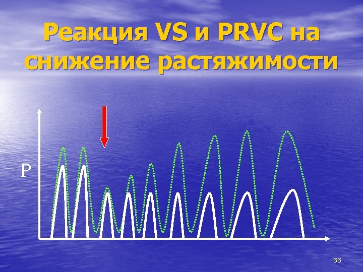 Реакция VS и PRVС на снижение растяжимости P 66 