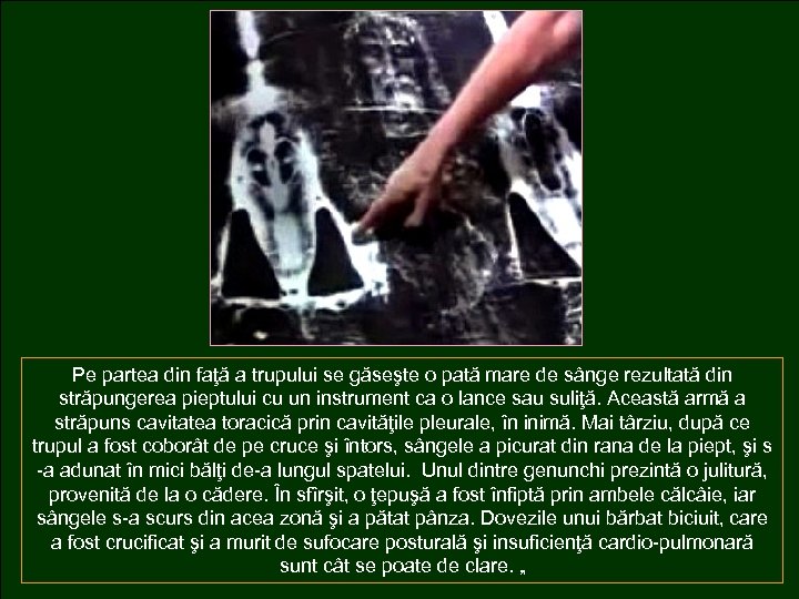 Pe partea din faţă a trupului se găseşte o pată mare de sânge rezultată