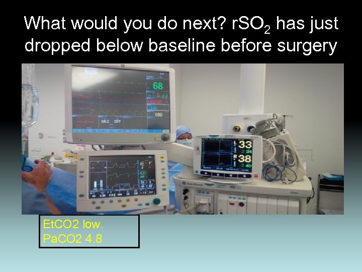 What would you do next? r. SO 2 has just dropped below baseline before