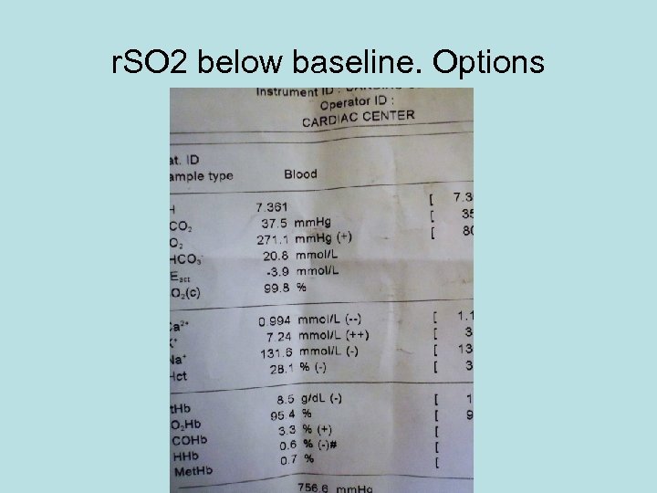r. SO 2 below baseline. Options 
