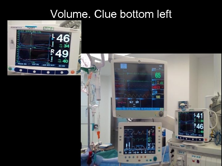 Volume. Clue bottom left 