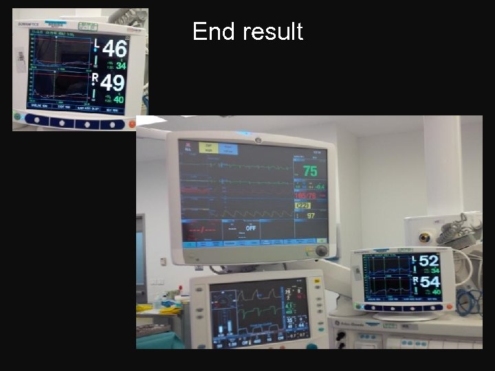 End result 