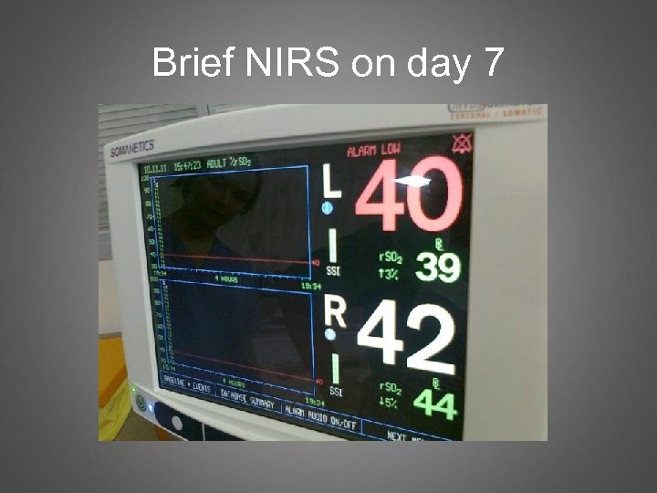 Brief NIRS on day 7 