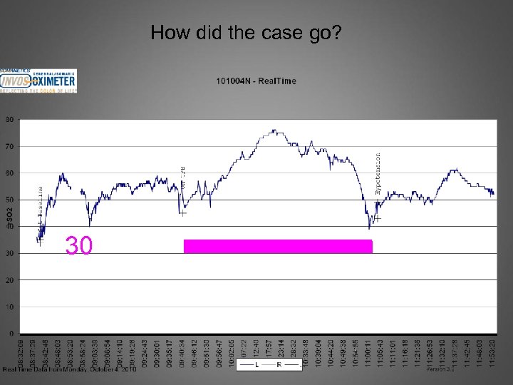 How did the case go? 30 