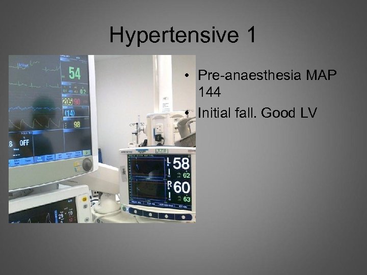 Hypertensive 1 • Pre-anaesthesia MAP 144 • Initial fall. Good LV 